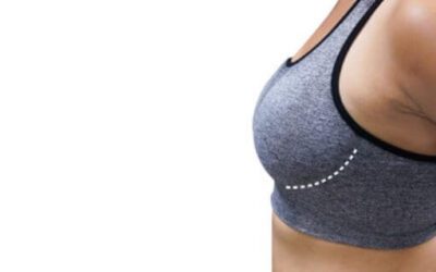 What Procedures Are Available for the Nipples/Areolas?