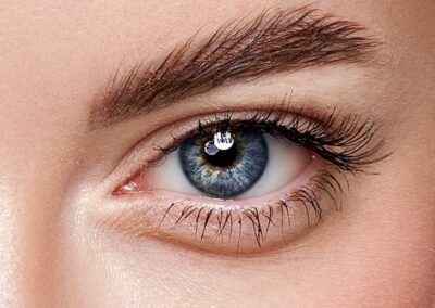 Upper Blepharoplasty