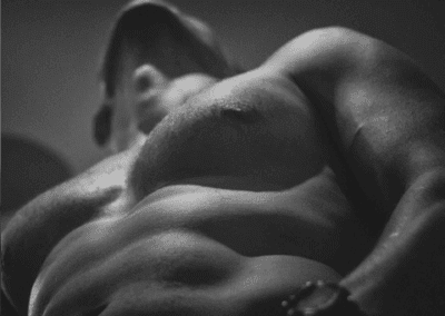 Male Breast Reduction
