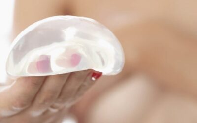 How Often Do I Need to Redo My Breast Implants?