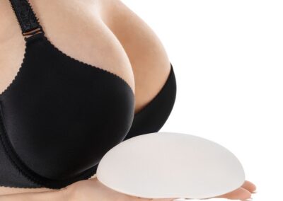 Breast Implant Exchange