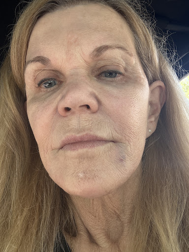 Photo from customer review