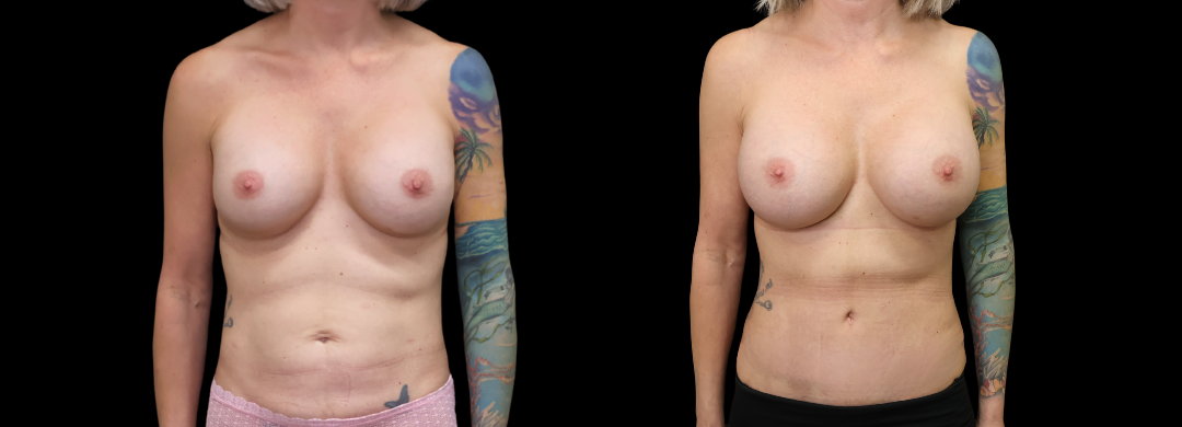 Me Again Makeover Patient 59 Me Again Makeover Patient 59